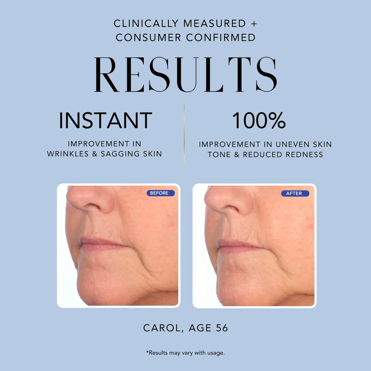 Nakery The Age Edit Time Erasing Serum - 1.7 oz